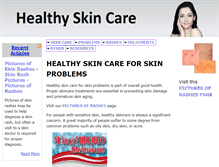 Tablet Screenshot of healthy-skincare.com